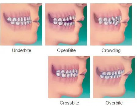 How Can Orthodontic Treatment Transform Your Life?