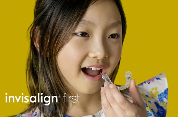 Invisalign First (Clear Plate Treatment in Children) - Dart Dental Clinic