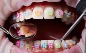 What's the difference between a dentist and an orthodontist in Seattle